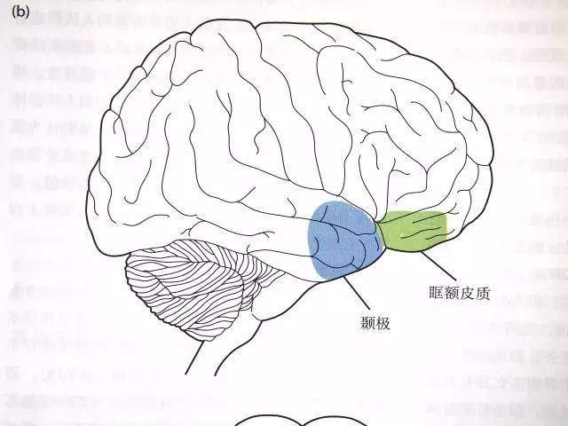 脑外伤会影响智商吗,脑外伤后影响智力吗