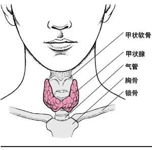 三岁女孩脖子侧面有个疙瘩,小女孩脖子甲状腺肿大