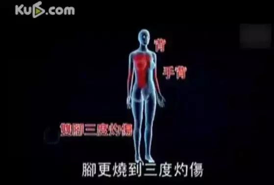 烧伤事件双方粉丝互撕六年，他们承受无尽痛苦，却总是被揭旧伤疤