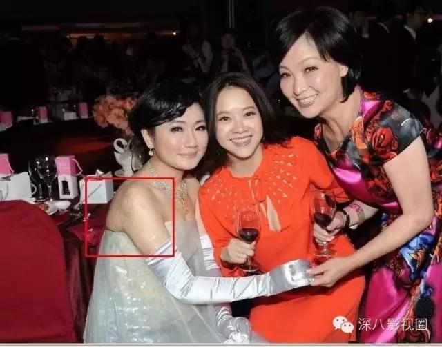 烧伤事件双方粉丝互撕六年，他们承受无尽痛苦，却总是被揭旧伤疤