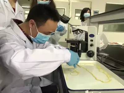 男子的肚子里养个寄生虫,男子肚子里有很多虫子