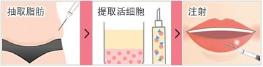 改善不完美的唇型,怎样的唇型是完美唇型