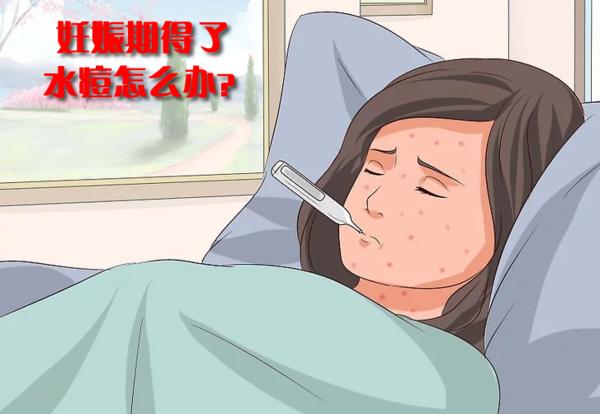 同寝室的得了水痘怎么办,婴儿得水痘怎么办