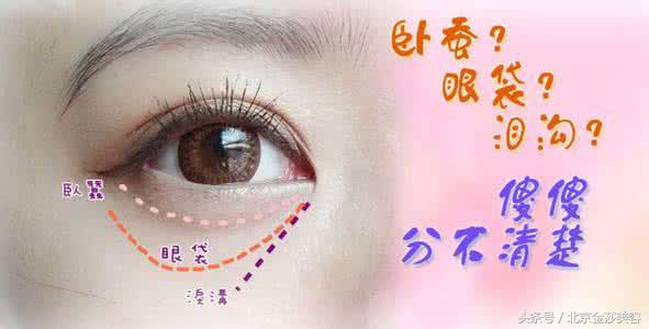 泪沟和眼袋有什么区分？预防及治疗方法有哪些？