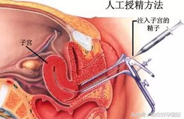 面对不孕是试管还是等待自然受孕,人工授精和试管婴儿到底怎么选