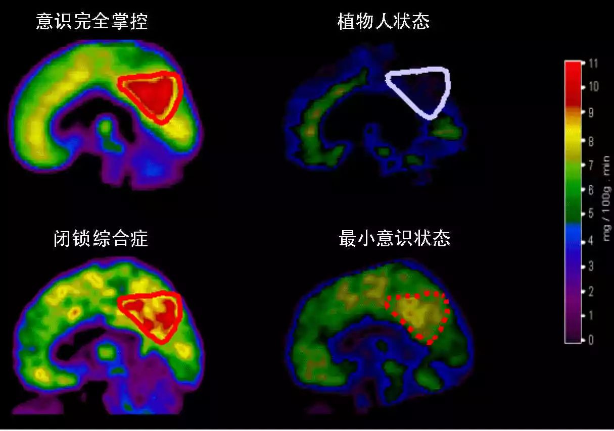 死亡是什么,死亡到底是意味着什么