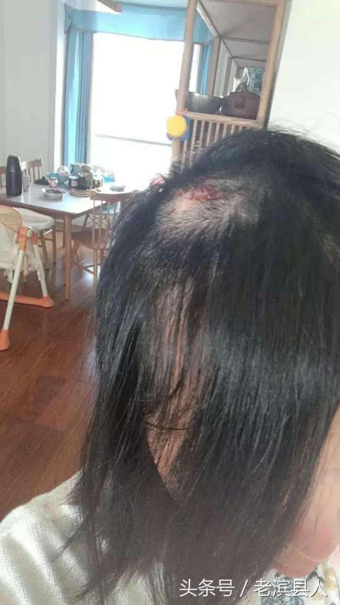 面条机动手起来很危险吗,面条机做出来不圆滑