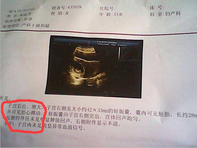 孕期B超单透露的重要信息！教你看懂9大关键指标