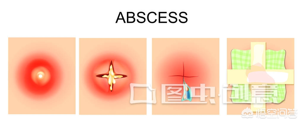天干物燥多注意身体,天干物燥谨慎过敏