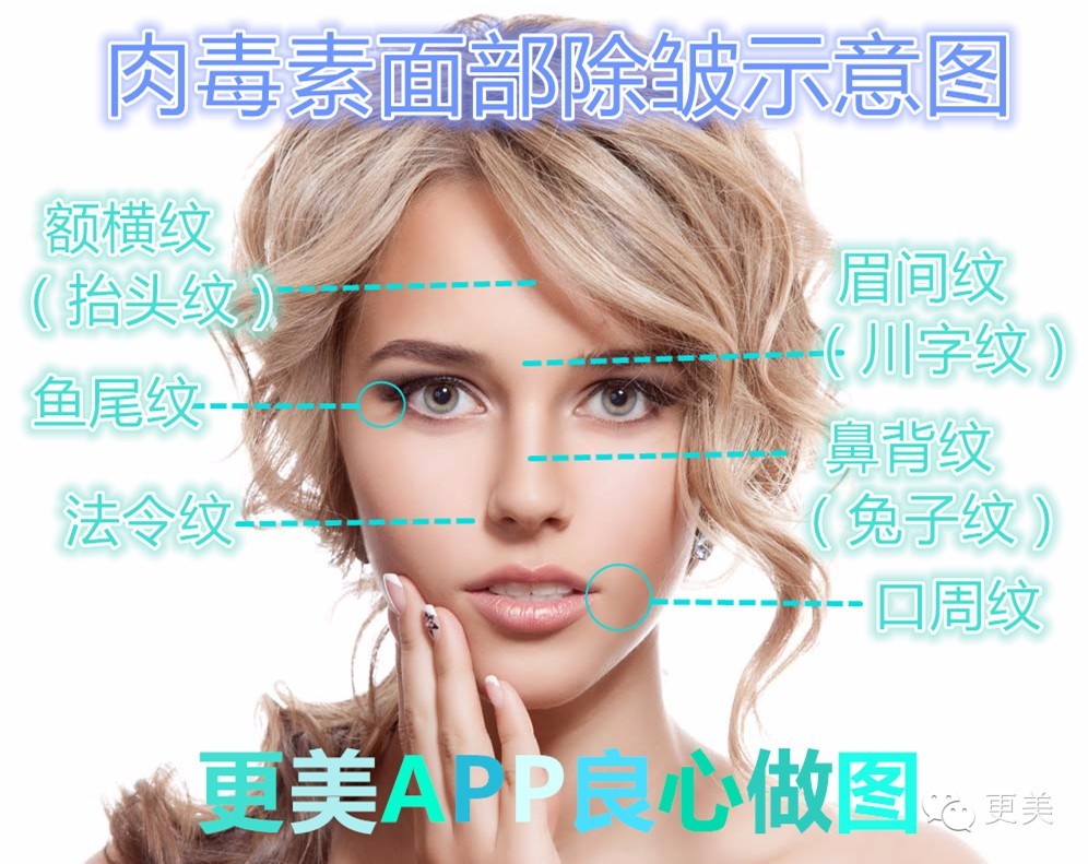 瘦脸针只打一针管用吗,瘦脸针只瘦咬肌吗