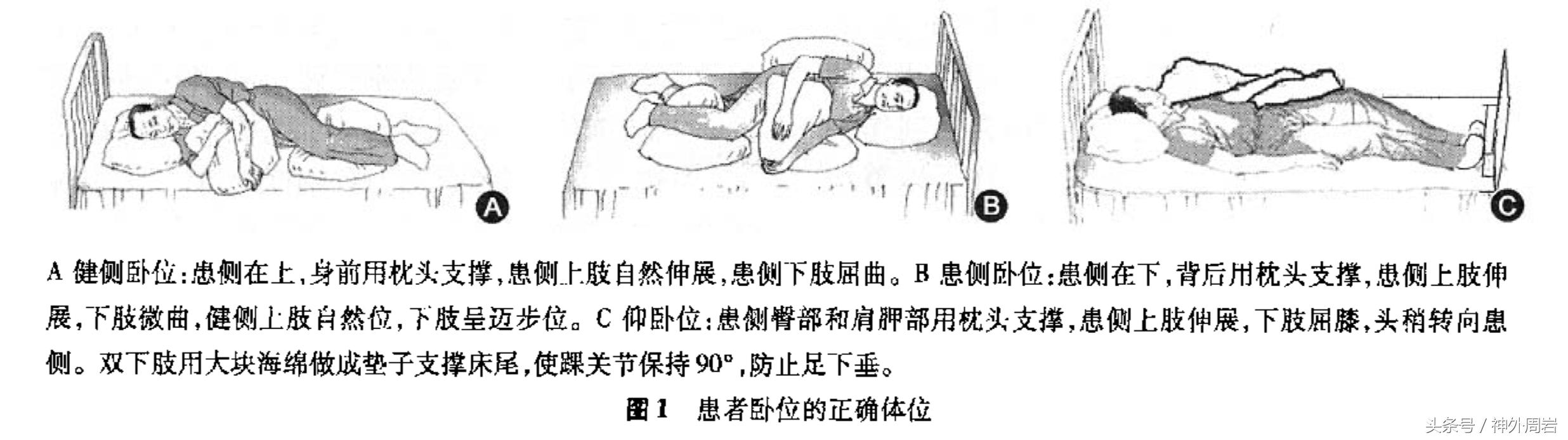 脑卒中前期康复训练,脑卒中康复训练3-4期