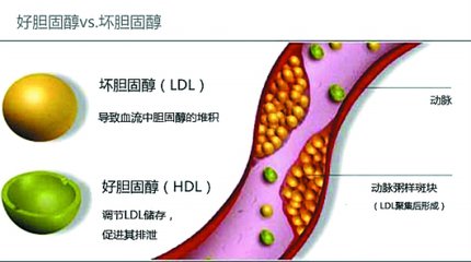 关于胆固醇的9个真相,关于胆固醇的基本知识