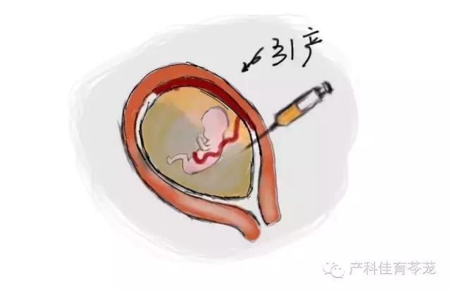 羊水过多和过少的原因,怎么预防羊水过多或过少