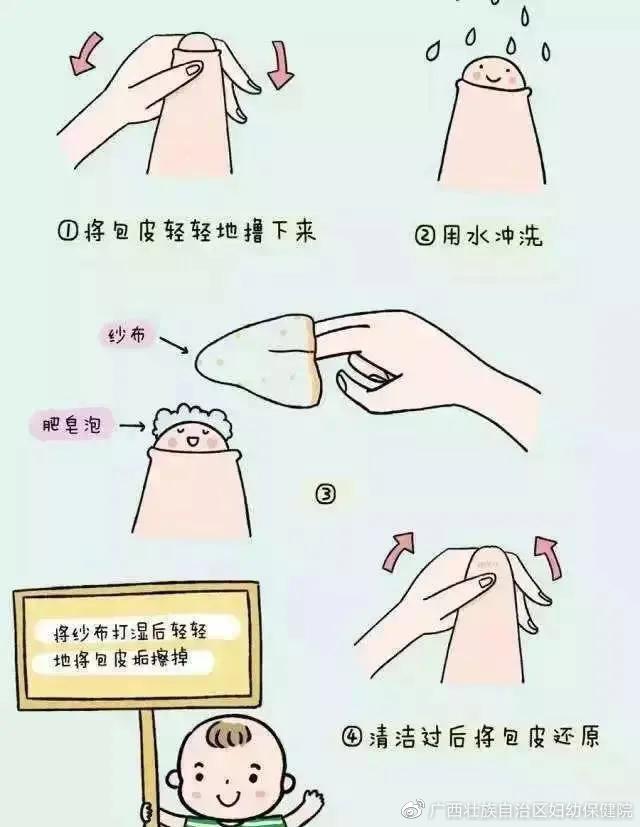 鍖呯毊杩囬暱鐨勭棁鐘跺拰鍗卞鍎跨绉戞櫘,瀹堕暱鎬庝箞瀵瑰皬瀛╄棰勯槻鍖呯毊杩囬暱