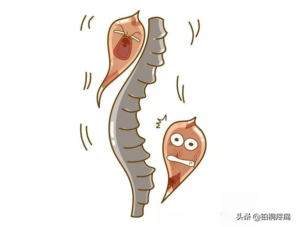 腰痛反反复复，一到天冷就发作，腰肌劳损该如何应对？