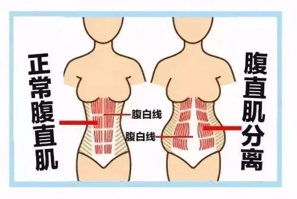 「爱禧课堂」生完孩子肚子还跟怀孕一样，原来是这样！