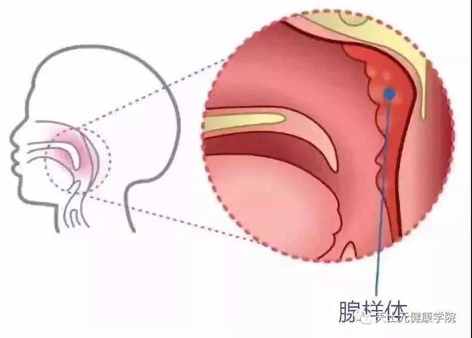 小孩腺样体肥大可以中药调理好吗,孩子腺样体肥大容易上火怎么调理