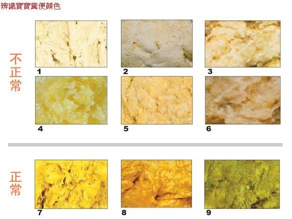 宝宝大便颜色看状态,儿童便便颜色看出健康状态