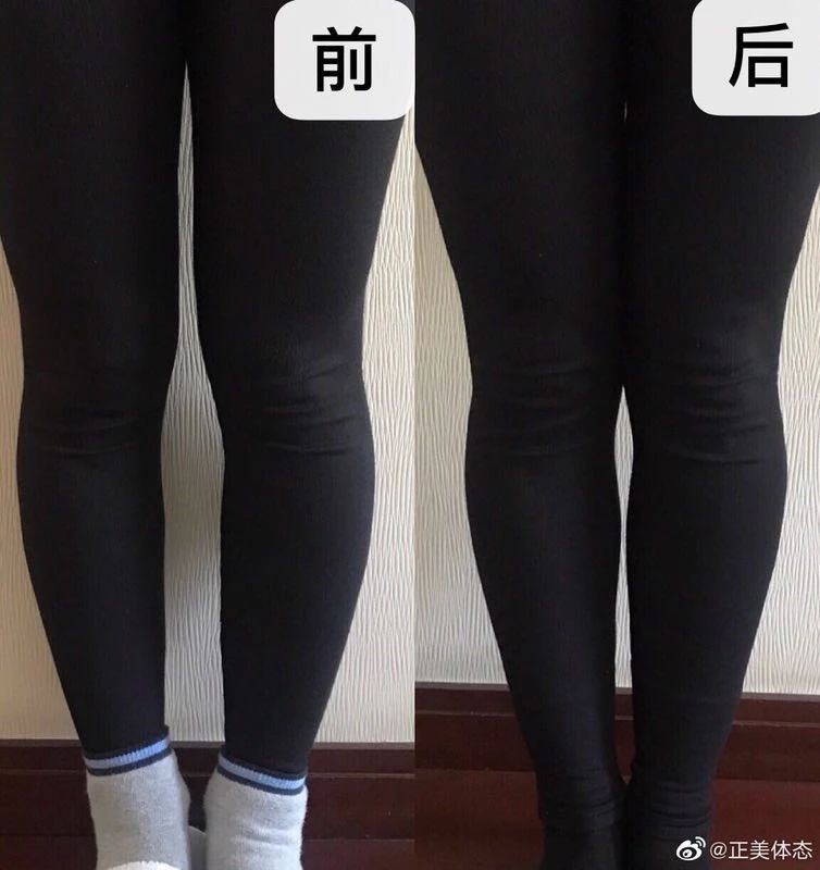 怎么样让大腿更直,怎么让大腿型变直