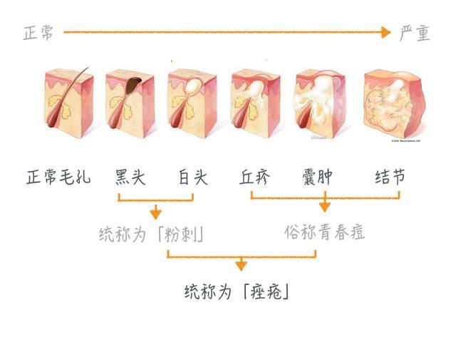 疮痈用药大全,医院治疗痤疮常用的处方药