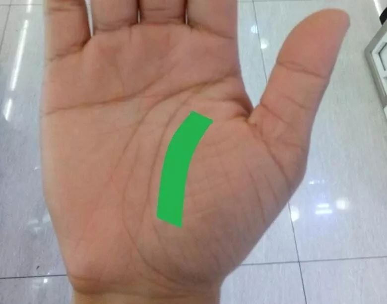 手上出现这些变化可能是疾病信号,手的颜色能看出健康的问题吗