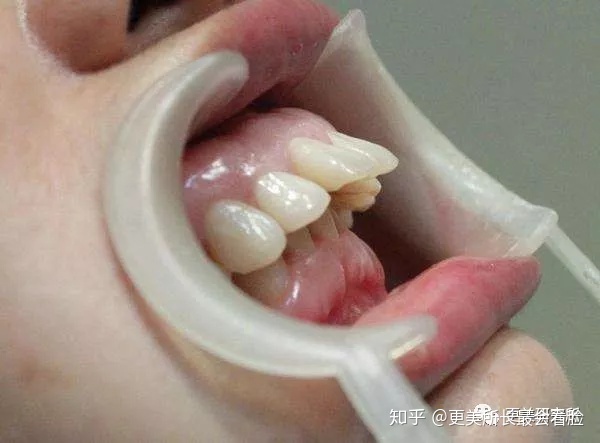 好看的侧脸要符合哪些条件,好看的侧脸的标准