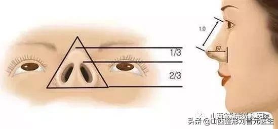 隆鼻的真实感受男生,男生隆鼻和女生的区分
