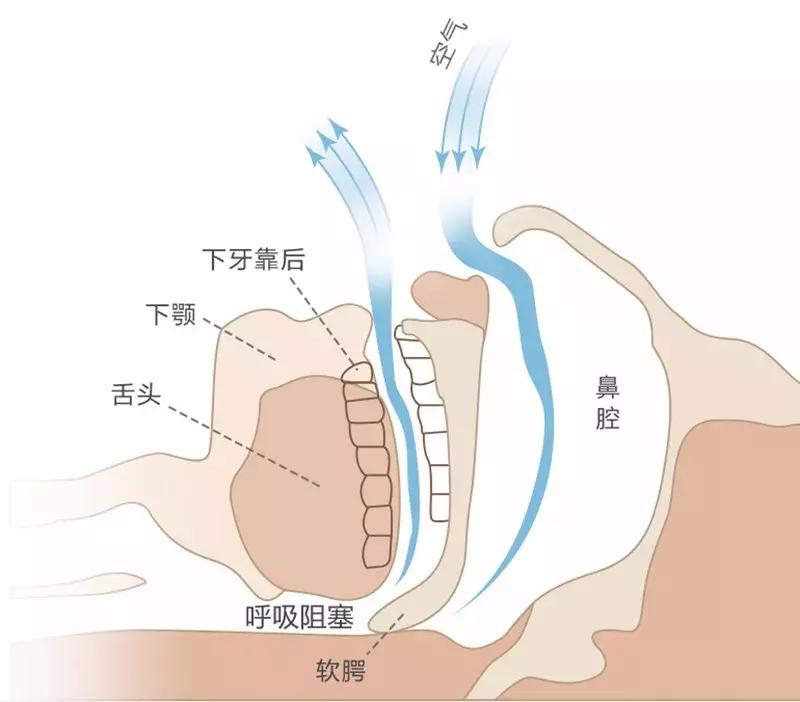 转一转头，枕边10年的鼾声消失了