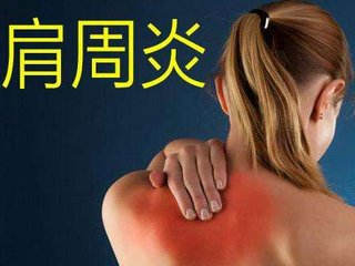 专门治肩周炎的药有哪些,治疗肩周炎的药物都有哪些
