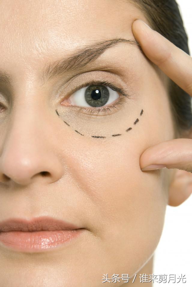 22岁眼部细纹明显,22岁眼部细纹严重需求用精华吗
