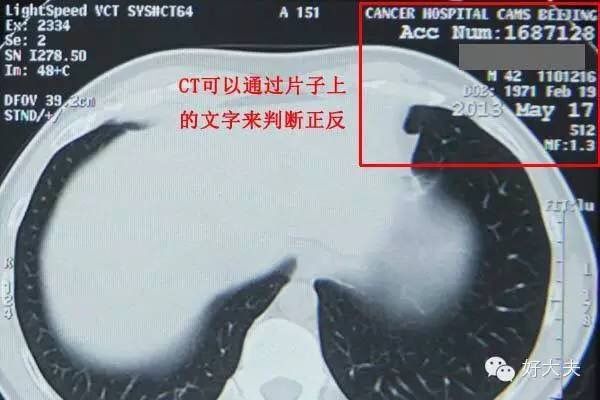 家里怎么拍片子给医生,如何把拍的ct片发给医生