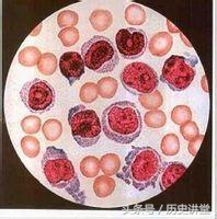 谁是药神陆勇,谁才是药神原版