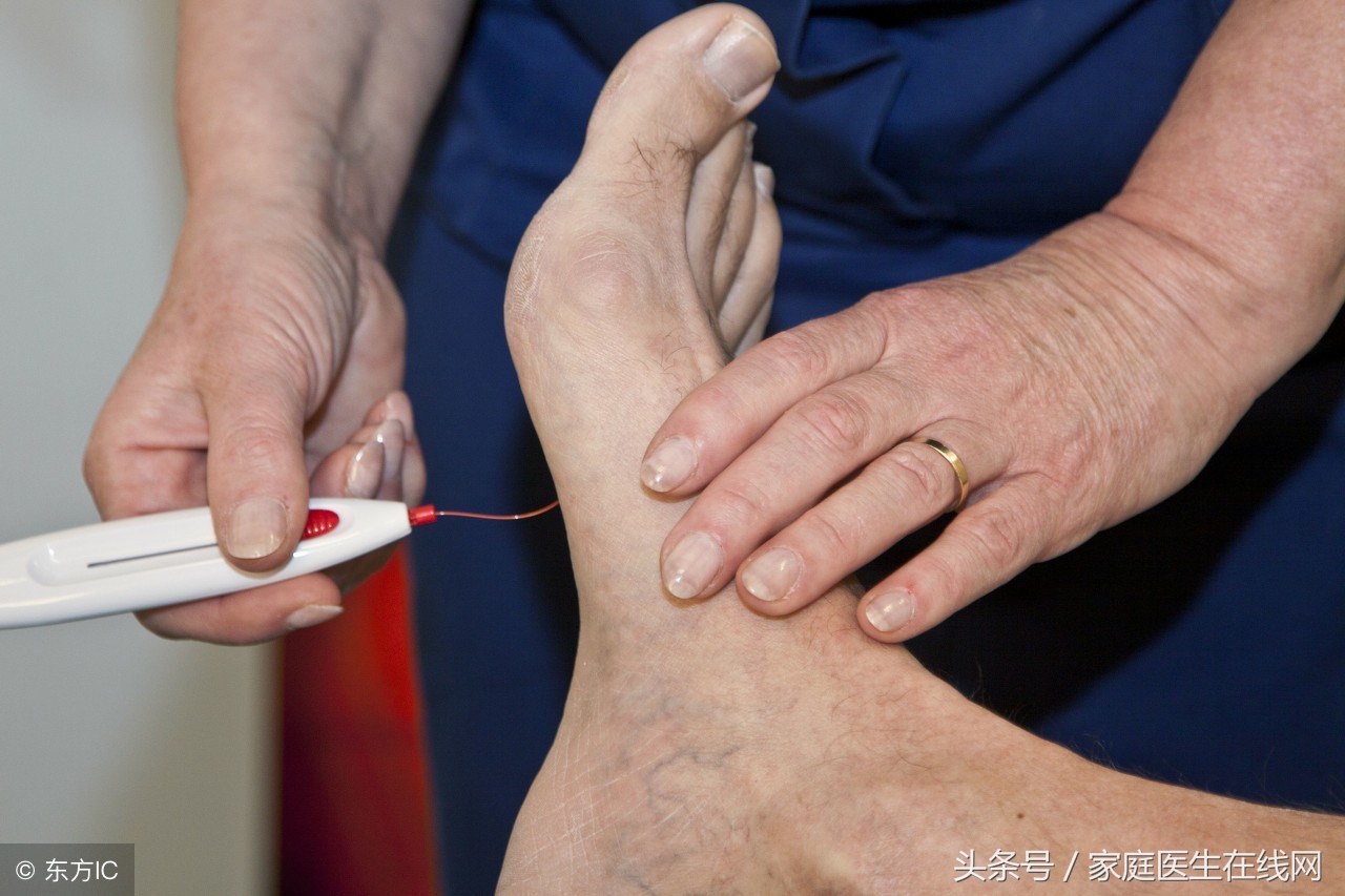 如果不想得糖尿病不能吃哪些食物,不想得糖尿病需求注意哪些事项