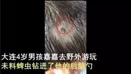 潍坊所有的家长，这种虫子传播新型艾滋病，最喜欢叮咬孩子……