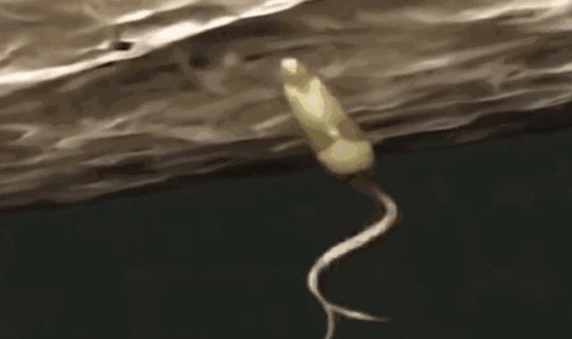 吃活物有寄生虫,吃活的虫子身体里有寄生虫