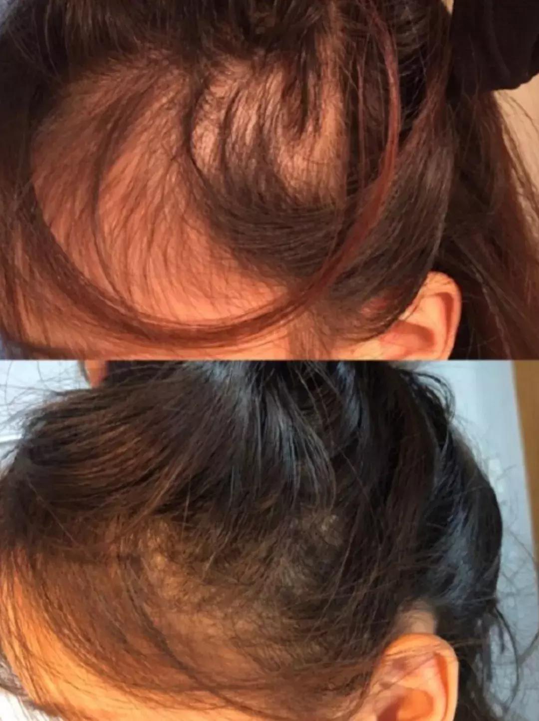 这届90后女孩，不配拥有戴森卷发棒