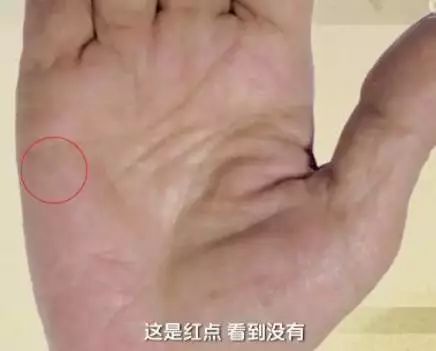 手上出现这些变化可能是疾病信号,手的颜色能看出健康的问题吗