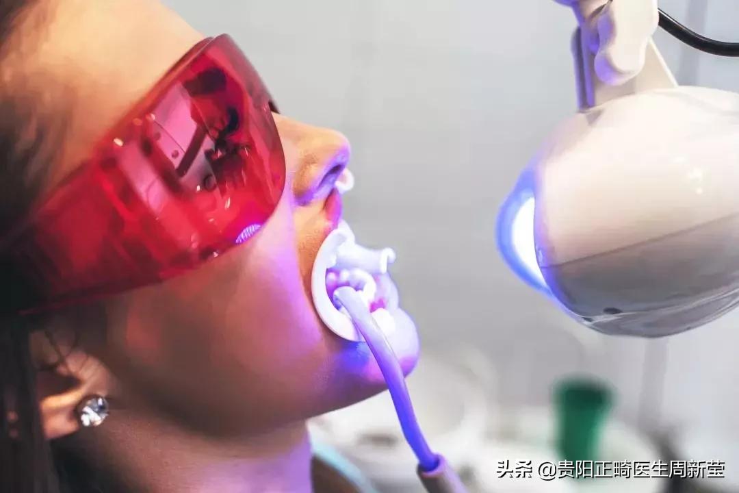 市面上冷光美牙仪真的有用吗,蓝光美白牙仪真的管用吗