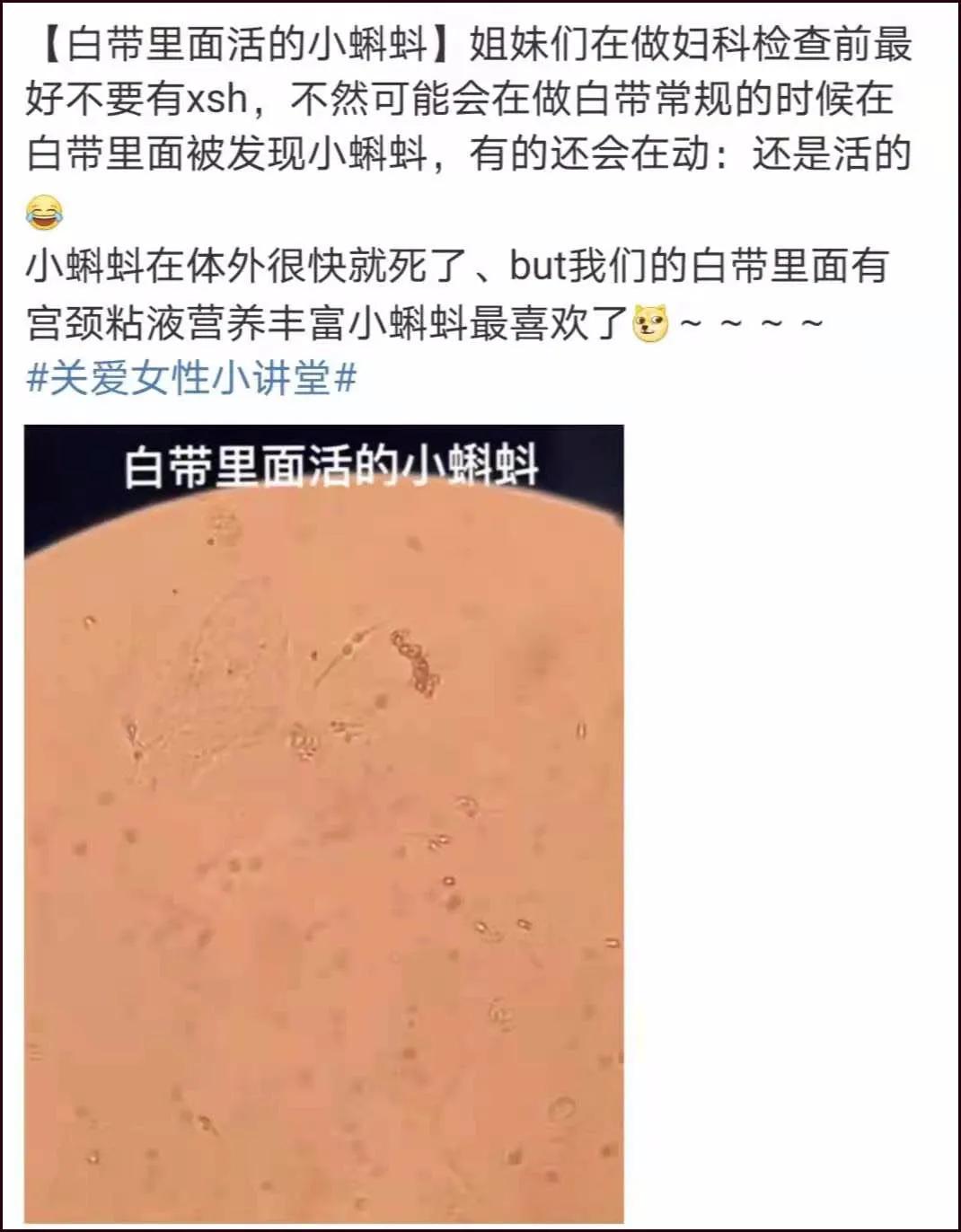 第一次去妇科检查需求注意什么,第一次产检妇科检查都有哪些项目