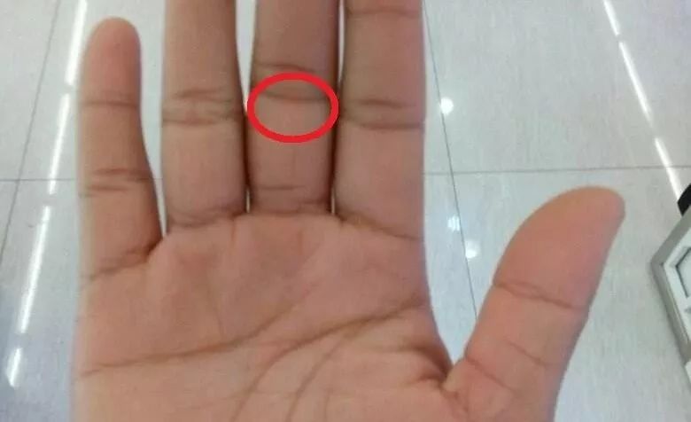 手上出现这些变化可能是疾病信号,手的颜色能看出健康的问题吗