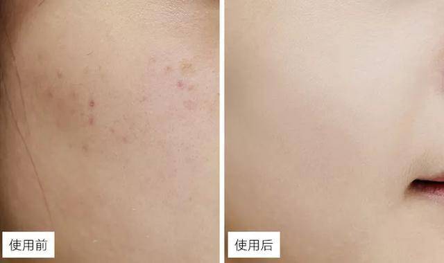 珂润跟片仔癀哪个好,片仔癀和珂润哪个好用