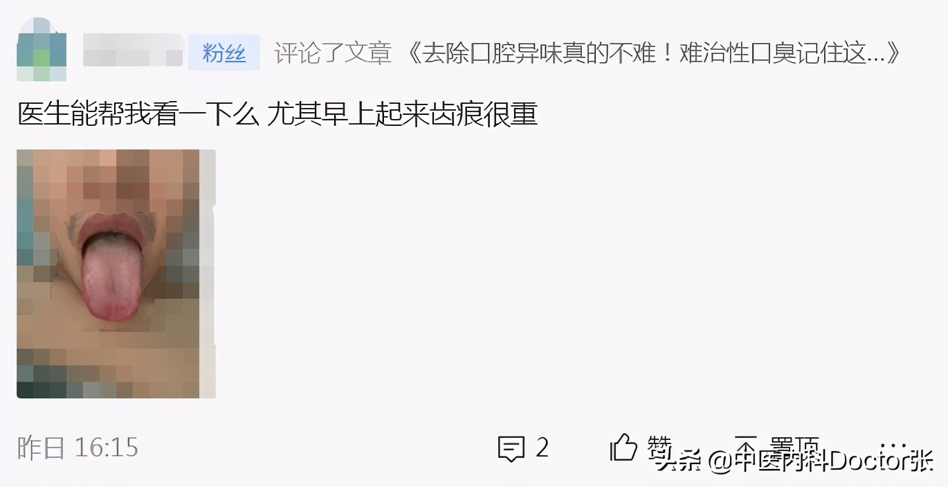一分钟辨别自己是什么肤质,分辨脾胃湿热和寒湿最简单的方法