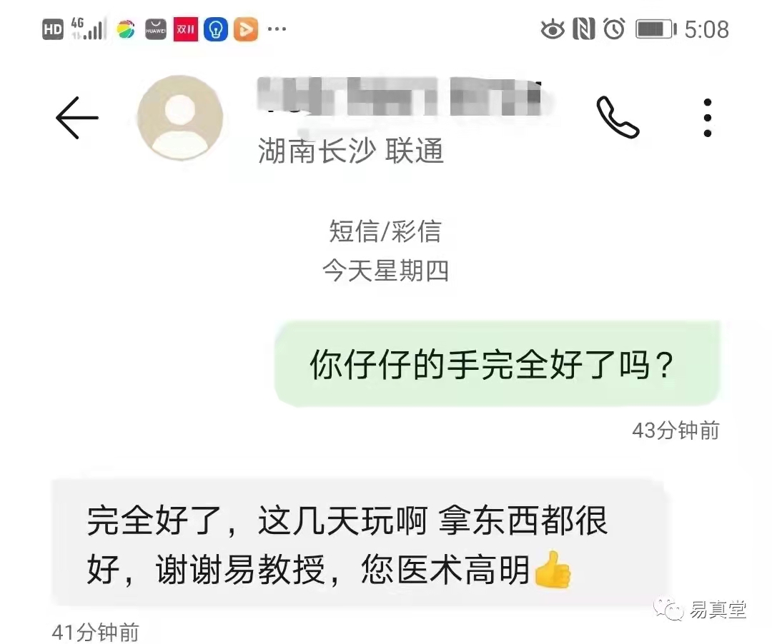 小儿桡骨小头半脱位图,桡骨小头半脱位复位最佳时间