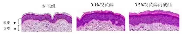 olay超a眼霜和露得清,olay超a眼霜有用吗