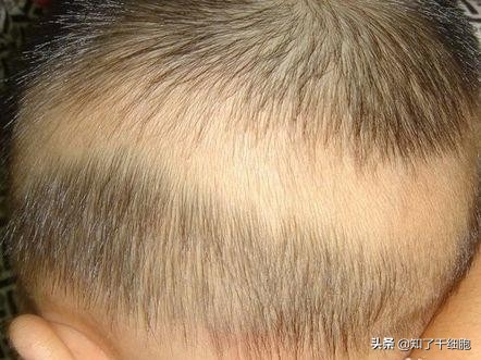 给孩子剃胎毛的小妙招,剃胎毛对宝宝有哪些好处