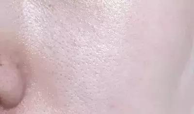 蒂佳婷的V7激光霜它的强力美白淡斑提亮到底有多强大？