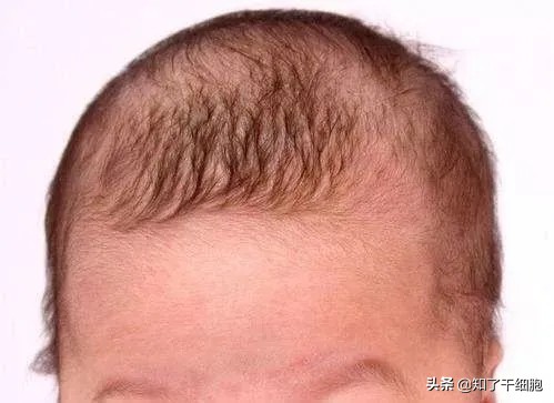 给孩子剃胎毛的小妙招,剃胎毛对宝宝有哪些好处