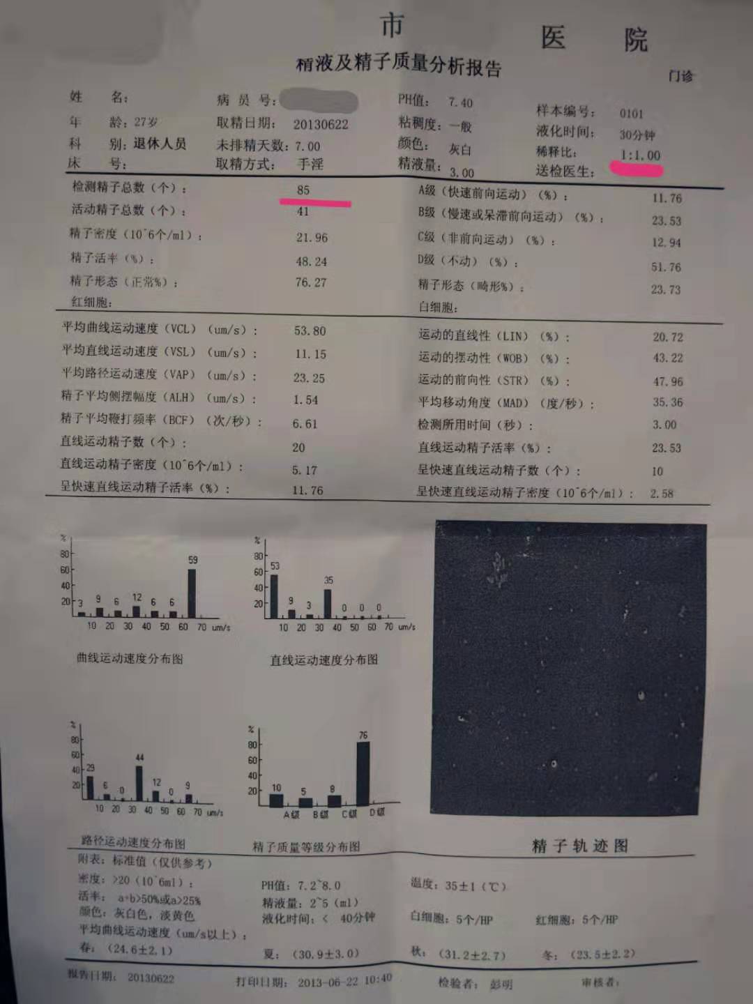 小蝌蚪检测需求多久,小蝌蚪常规报告怎么看