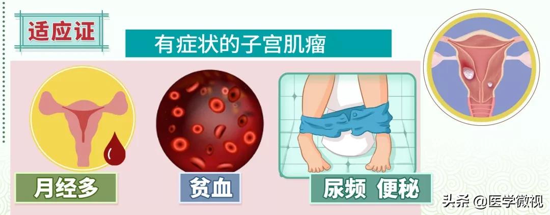 女性多发癌症,女人患上全球仅有300例的罕见肿瘤