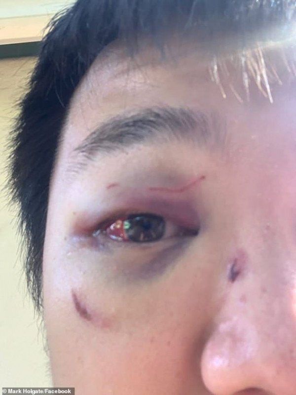 澳大利亚华人留学生被暴打,澳大利亚大学华人学生被打事件